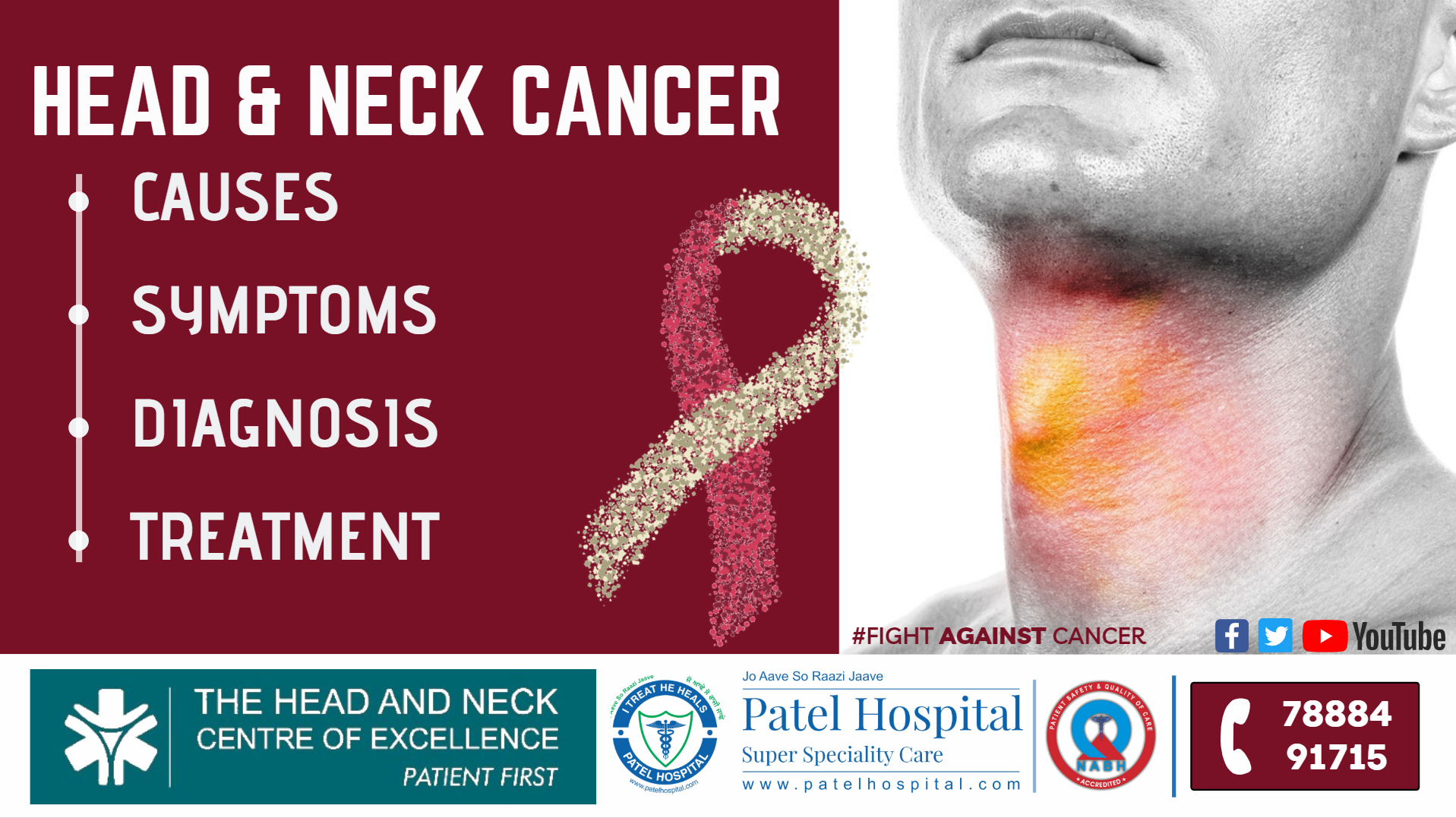 HEAD & NECK CANCERS: Causes, Symptoms, Diagnosis & Treatment