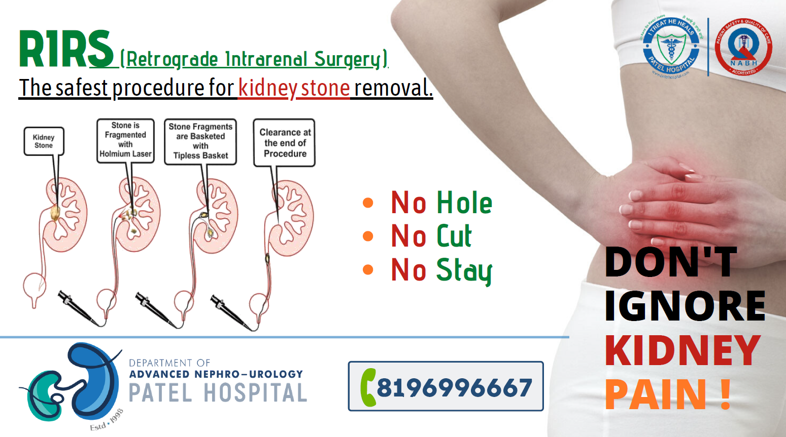 Retrograde Intrarenal Surgery (RIRS) – The safest procedure for kidney stone removal.