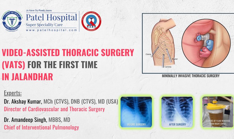 Scarless Lung Surgery for the first time in Jalandhar, Punjab