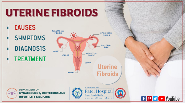 Uterine Fibroids: Causes, Symptoms, Diagnosis & Treatment