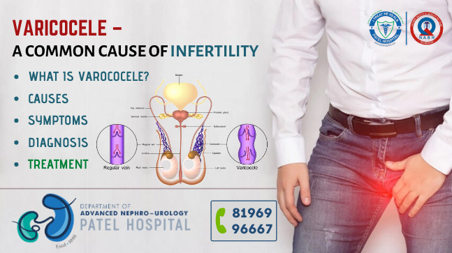 Varicocele – A common cause of infertility