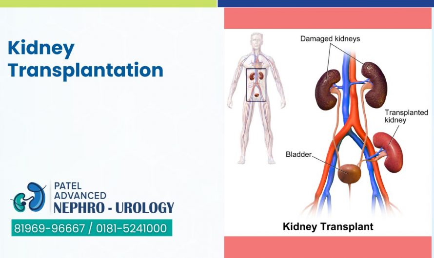 Kidney Transplantation- Best Kidney Transplant Hospital in Jalandhar, Punjab