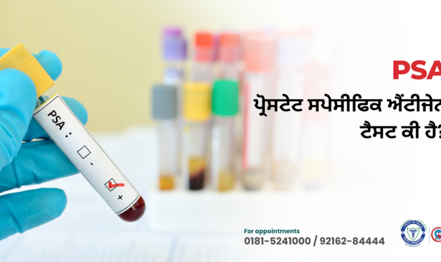 Prostate Specific Antigen PSA Test in Jalandhar