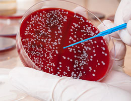 Blood Cancers treatment in Phagwara, Punjab